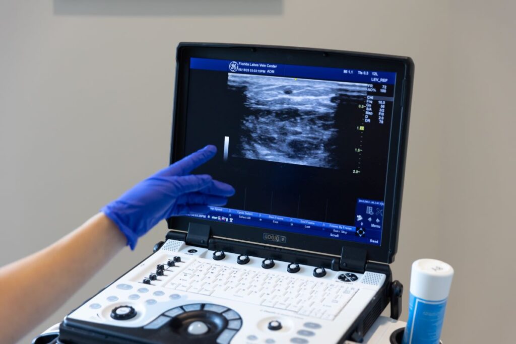 Picture of a computer screen showing a vein scan with a provider's finger pointing out a detail for Lymphedema Treatment in North Port
